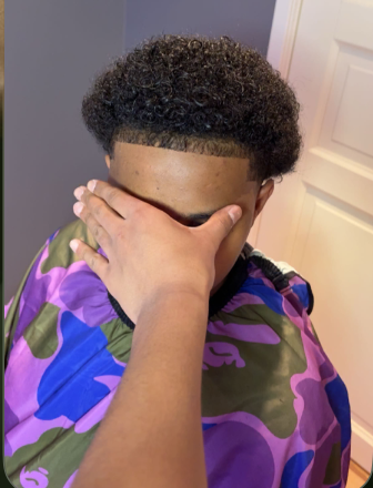 Hairline