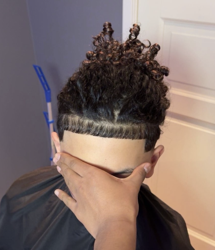 Hairline